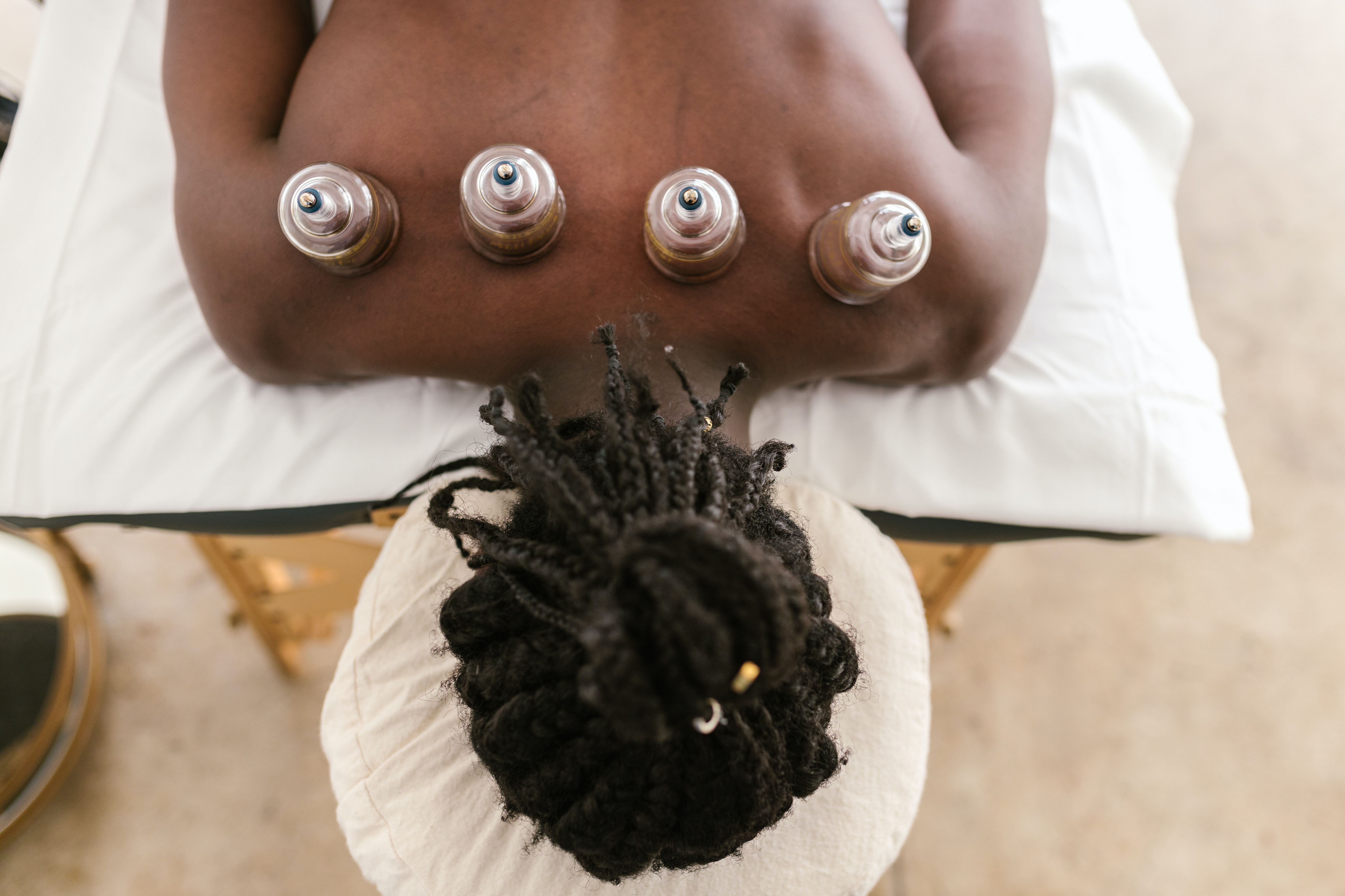 Cupping therapy